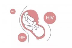 患有艾滋病(HIV)病毒可以做第三代试管婴儿吗？